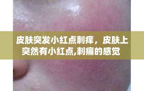皮肤突发小红点刺痒，皮肤上突然有小红点,刺痛的感觉 